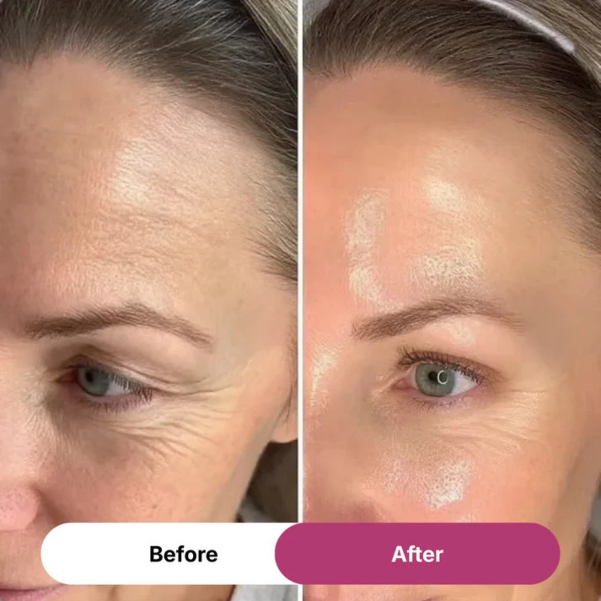Lunea™ PDRN Collagen Wrinkle Balm