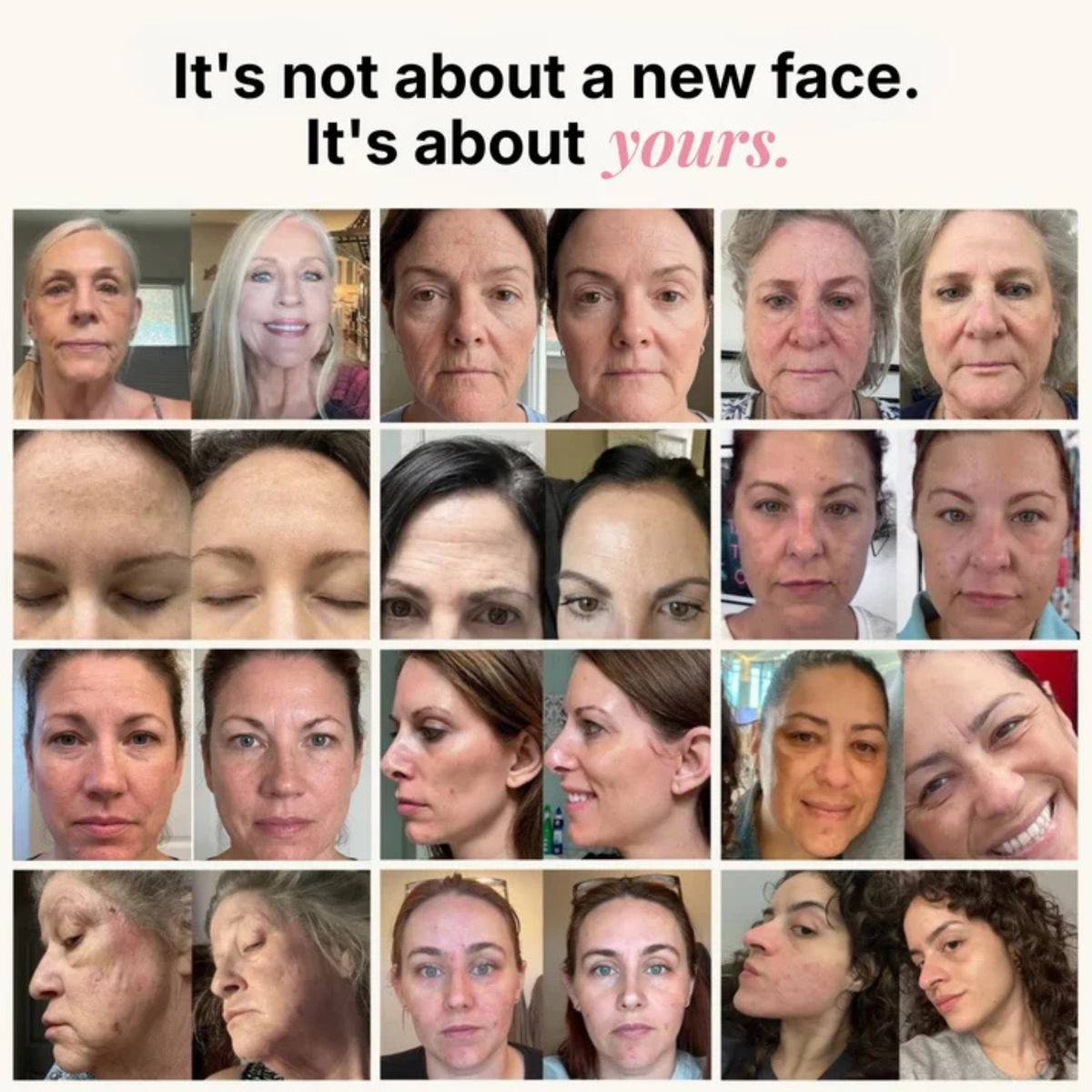 Lunea™ PDRN Collagen Wrinkle Balm