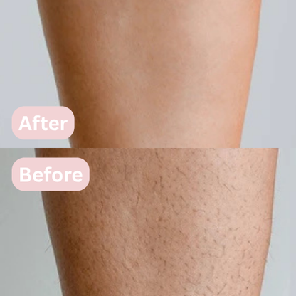 Lunea™ – 2-in-1 Women’s Body Shaver