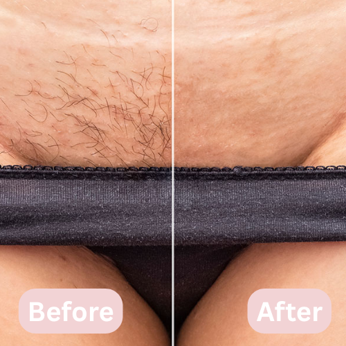 Lunea™ – 2-in-1 Women’s Body Shaver