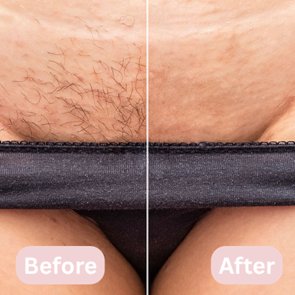 Lunea™ – 2-in-1 Women’s Body Shaver