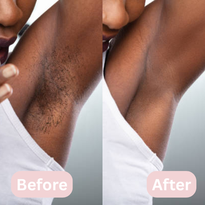 Lunea™ – 2-in-1 Women’s Body Shaver